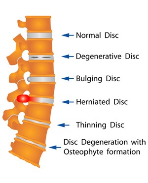 Neck And Back Pain Treatment